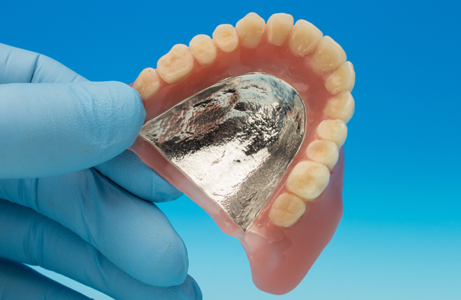 
								金属床義歯
