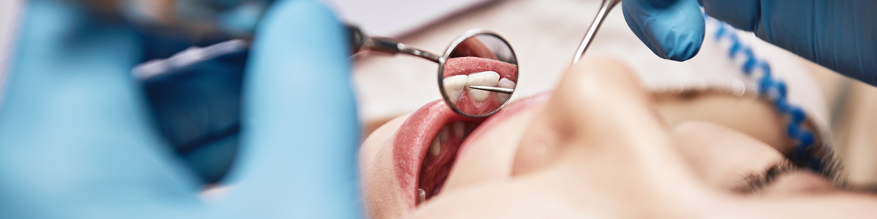 歯科一般・口腔外科・小児歯科