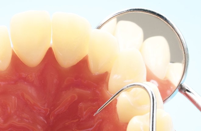 歯周病の進行と検査・治療方法